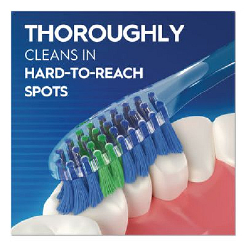 Oral-B Advanced Clean Soft Bristle Toothbrush, Randomly Assorted Colors, 72/Carton (10998)