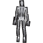 Roylco True to Life Human X-rays Set (R5911)