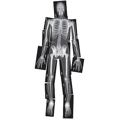 Roylco True to Life Human X-rays Set (R5911)